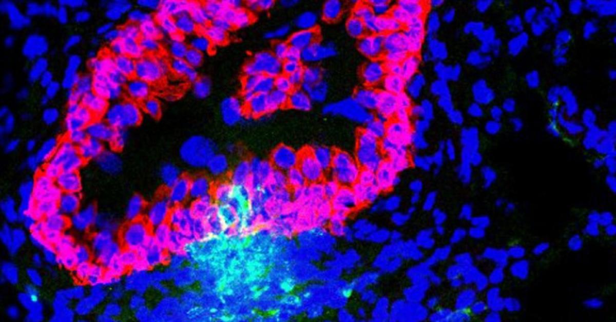 Goodbye Utis Duke Scientists Jianxuan Wu And Soman Abraham Develop Vaccine Strategy For Urinary 8301